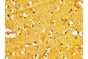 IHC image of ABIN7168283 diluted at 1:300 and staining in paraffin-embedded human brain tissue performed on a Leica BondTM system.