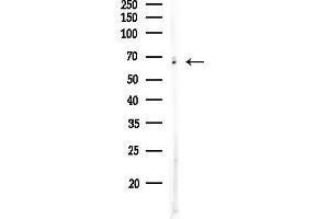 Western blot analysis of lysates from Mouse brain, using Phospho-LK (Ser428) Antibody at 1/1000 dilution.