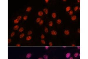 Immunofluorescence analysis of C6 cells using IPO8 Polyclonal Antibody at dilution of 1:100.