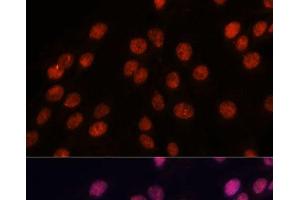 Immunofluorescence analysis of C6 cells using IPO8 Polyclonal Antibody at dilution of 1:100. (Importin 8 anticorps)