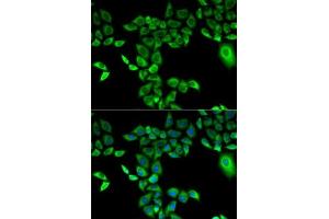 Immunofluorescence analysis of A-549 cells using FMO3 antibody (ABIN3015685, ABIN3015686, ABIN3015687 and ABIN6219039).