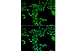 Immunofluorescence analysis of A-549 cells using FMO3 antibody (ABIN3015685, ABIN3015686, ABIN3015687 and ABIN6219039). (FMO3 anticorps  (AA 263-532))