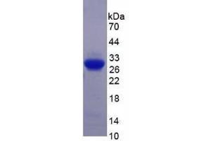 SDS-PAGE analysis of Human Semaphorin 5B Protein. (SEMA5B Protéine)