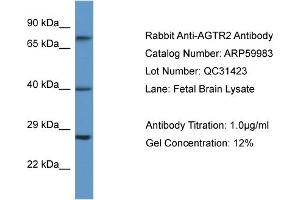 Western Blotting (WB) image for anti-Angiotensin II Receptor, Type 2 (AGTR2) (N-Term) antibody (ABIN2788290) (Angiotensin II Type 2 Receptor anticorps  (N-Term))