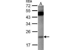 WB Image Sample (30 ug of whole cell lysate) A: HCT116 12% SDS PAGE antibody diluted at 1:500 (RAP1B anticorps)