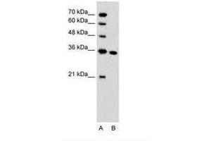 Image no. 1 for anti-Solute Carrier Family 25, Member 29 (SLC25A29) (C-Term) antibody (ABIN205008) (SLC25A29 anticorps  (C-Term))