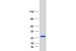 Validation with Western Blot