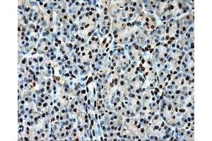 Immunohistochemical staining of paraffin-embedded Kidney tissue using anti-LOXmouse monoclonal antibody. (LOX anticorps  (AA 22-168))