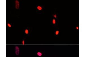 Immunofluorescence analysis of A431 cells using GTF2I Polyclonal Antibody at dilution of 1:100. (GTF2I anticorps)
