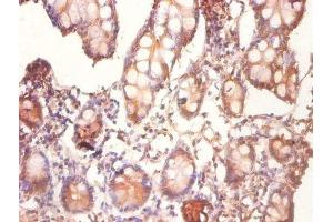 Immunohistochemistry of paraffin-embedded human small intestine tissue using ABIN7148869 at dilution of 1:100 (CDK2AP1 anticorps  (AA 1-115))