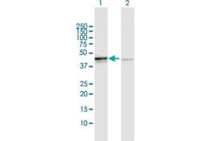 Western Blot analysis of OXA1L expression in transfected 293T cell line by OXA1L MaxPab polyclonal antibody. (OXA1L anticorps  (AA 1-435))