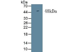 Detection of Recombinant ISLR, Human using Monoclonal Antibody to Immunoglobulin Superfamily Containing Leucine Rich Repeat Protein (ISLR)