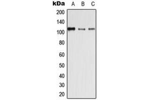 Western blot analysis of Desmoglein 4 expression in HEK293T (A), SP2/0 (B), H9C2 (C) whole cell lysates. (Desmoglein 4 anticorps  (Center))