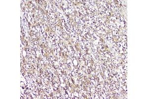 IHC analysis of LCP1 using anti-LCP1 antibody (ABIN6719421). (LCP1 anticorps)