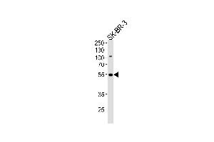 Western blot analysis of lysate from SK-BR-3 cell line, using SMARCE1 Antibody at 1:1000 at each lane.