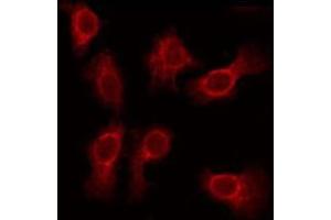 ABIN6275615 staining Hela by IF/ICC. (SVOP anticorps  (Internal Region))