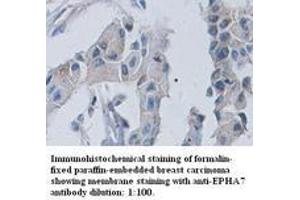 Image no. 1 for anti-EPH Receptor A7 (EPHA7) (C-Term) antibody (ABIN791047) (EPH Receptor A7 anticorps  (C-Term))