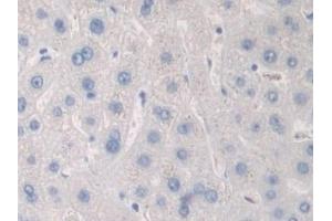 Detection of PKD2 in Human Liver Tissue using Polyclonal Antibody to Protein Kinase D2 (PKD2)