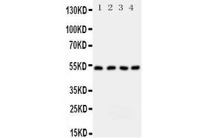 Western Blotting (WB) image for anti-serine Palmitoyltransferase, Long Chain Base Subunit 1 (SPTLC1) (AA 138-154), (Middle Region) antibody (ABIN3043056) (SPTLC1 anticorps  (Middle Region))