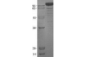 Validation with Western Blot (CDH6 Protein (His tag))