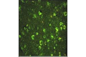 Immunofluorescence analysis of ABI1 Antibody (N-term) with paraffin-embedded human brain tissue.