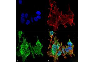 anti-Ankyrin 2, Neuronal (ANK2) (AA 203-496) antibody