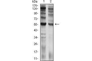 Western blot analysis using CD129 mouse mAb against C6 (1) and PC-3 (2) cell lysate.