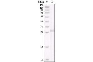 Western blot analysis using HER-2 antibody against truncated HER-2 recombinant protein. (ErbB2/Her2 anticorps)