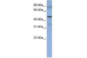 WB Suggested Anti-DAZAP1 Antibody Titration:  0. (DAZAP1 anticorps  (Middle Region))
