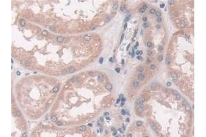 Detection of FUT6 in Human Kidney Tissue using Polyclonal Antibody to Fucosyltransferase 6 (FUT6)