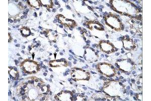 Image no. 1 for anti-Autophagy related 4B Cysteine Peptidase (ATG4B) (C-Term) antibody (ABIN6735868)