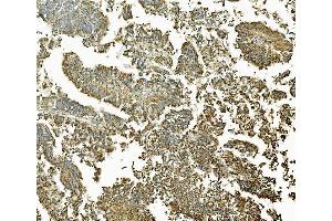 IHC analysis of MEK2/MAP2K2 using anti-MEK2/MAP2K2 antibody (ABIN7599357).