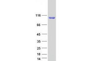 Validation with Western Blot