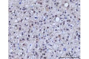 IHC analysis of RAD51C using anti-RAD51C antibody (ABIN7599718). (RAD51C anticorps  (AA 11-342))