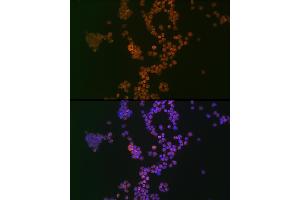 Immunofluorescence analysis of Jurkat cells using Ikaros Rabbit mAb (ABIN7267841) at dilution of 1:100 (40x lens).