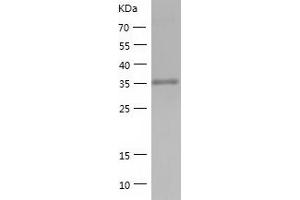 Western Blotting (WB) image for ADP-Ribosylarginine Hydrolase (ADPRH) (AA 1-357) protein (His-IF2DI Tag) (ABIN7121730)