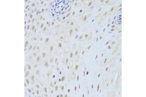 Immunohistochemistry of paraffin-embedded human esophagus using AIFM1 Antibody (ABIN5971393) at dilution of 1/200 (40x lens).
