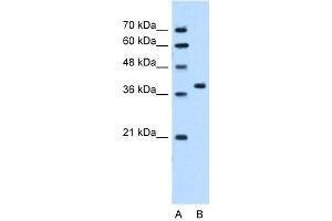 WB Suggested Anti-RUNDC2A Antibody Titration:  5. (SNX29 anticorps  (N-Term))