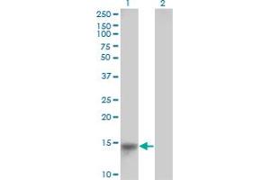 Western Blot analysis of LRRC8D expression in transfected 293T cell line by LRRC5 monoclonal antibody (M01), clone 3H1-1C2.