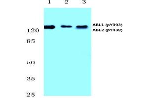 Western blot analysis of p-Abl1/2 antibody (pTyr393/439) Cat.