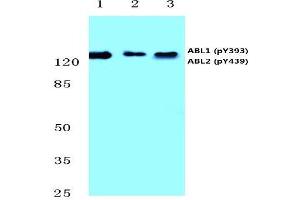 Western blot analysis of p-Abl1/2 antibody (pTyr393/439) Cat. (ABL1 anticorps  (pTyr393, pTyr439))