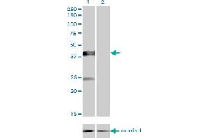 Western blot analysis of MGC26963 over-expressed 293 cell line, cotransfected with MGC26963 Validated Chimera RNAi (Lane 2) or non-transfected control (Lane 1).