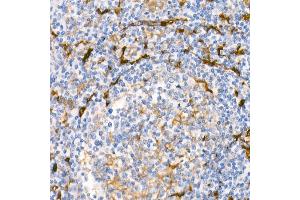 Immunohistochemistry of paraffin-embedded Human tonsil using Fascin/FSCN1 antibody (ABIN7267142) at dilution of 1:100 (40x lens). (Fascin anticorps)