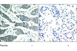 Image no. 1 for anti-V-Akt Murine Thymoma Viral Oncogene Homolog 1 (AKT1) (Tyr312), (Tyr315), (Tyr316) antibody (ABIN319374) (AKT1 anticorps  (Tyr312, Tyr315, Tyr316))