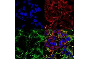 Immunocytochemistry/Immunofluorescence analysis using Mouse Anti-Neuroligin 3 Monoclonal Antibody, Clone S110-29 . (Neuroligin 3 anticorps  (AA 730-848) (HRP))