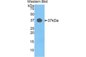 Detection of recombinant FBLN4 using Polyclonal Antibody to Fibulin 4 (FBLN4) (FBLN4 anticorps  (AA 278-366))
