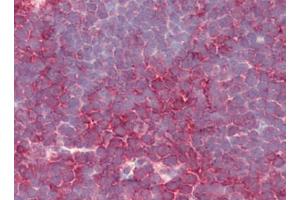 Human Thymus (formalin-fixed, paraffin-embedded) stained with PSENENat 5 µg/ml followed by biotinylated goat anti-rabbit IgG secondary antibody, alkaline phosphatase-streptavidin and chromogen. (PEN2 anticorps  (N-Term))