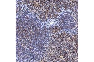 IHC analysis of TRMT61A using anti-TRMT61A antibody (ABIN7599220). (TRMT61A anticorps  (AA 1-289))