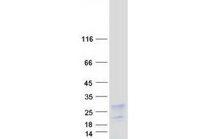 Validation with Western Blot