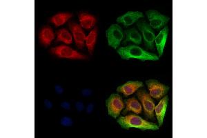 ABIN6263515 and ABIN6273059 staining Hela cells by IF/ICC. (NAPRT1 anticorps  (Internal Region))